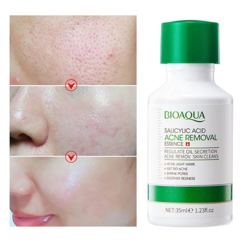 Serum Anti Acné con Ácido Salicílico Reparador de Poros de Bioaqua Esencia